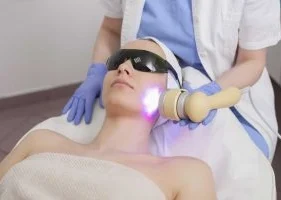 лазерный пилинг лица аппаратом MCL-30 Dermablate