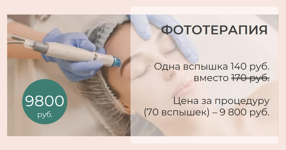 фототерапия, пигментация