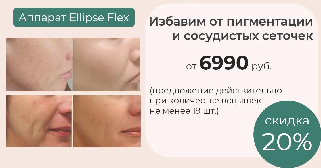 лечение сосудов и пигментации за 6990